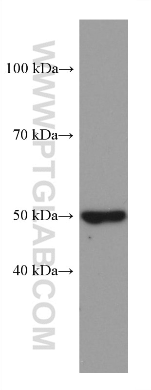 Western Blot (WB) analysis of Jurkat cells using OXCT1 Monoclonal antibody (67836-1-Ig)