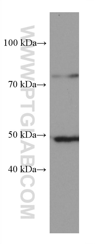 Western Blot (WB) analysis of pig brain tissue using OXCT1 Monoclonal antibody (67836-1-Ig)