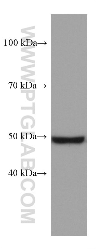 Western Blot (WB) analysis of rat brain tissue using OXCT1 Monoclonal antibody (67836-1-Ig)