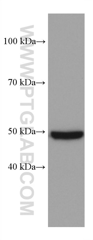 Western Blot (WB) analysis of mouse brain tissue using OXCT1 Monoclonal antibody (67836-1-Ig)