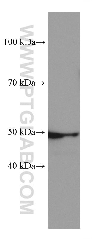 Western Blot (WB) analysis of rabbit brain tissue using OXCT1 Monoclonal antibody (67836-1-Ig)