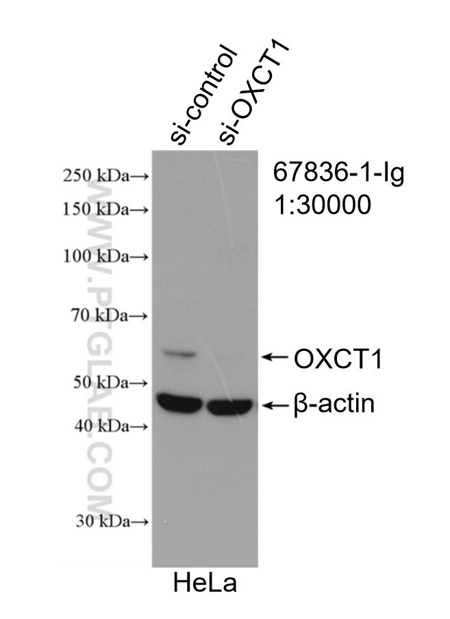 Western Blot (WB) analysis of HeLa cells using OXCT1 Monoclonal antibody (67836-1-Ig)