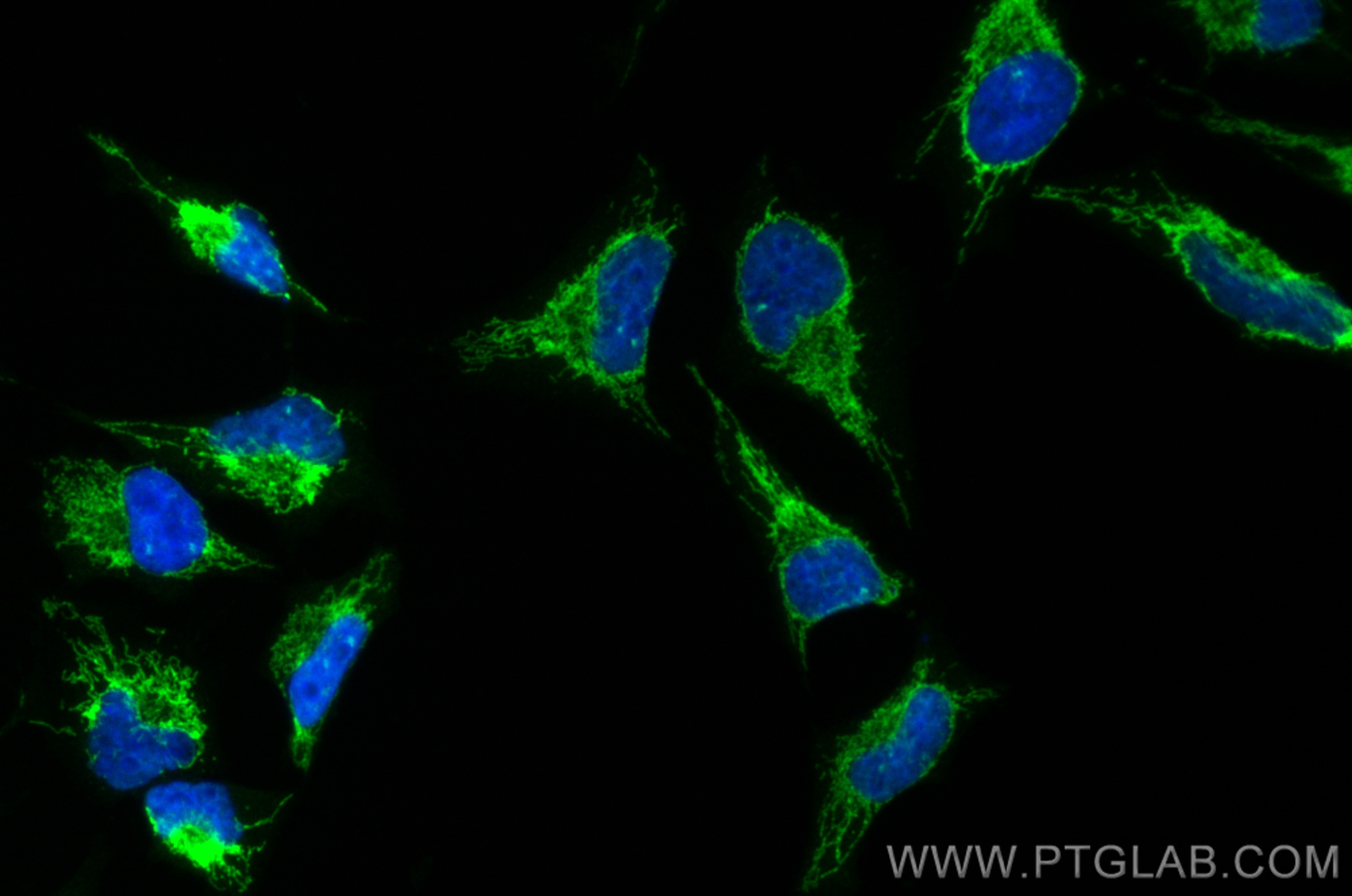 Immunofluorescence (IF) / fluorescent staining of HeLa cells using CoraLite® Plus 488-conjugated OXCT1 Polyclonal ant (CL488-12175)