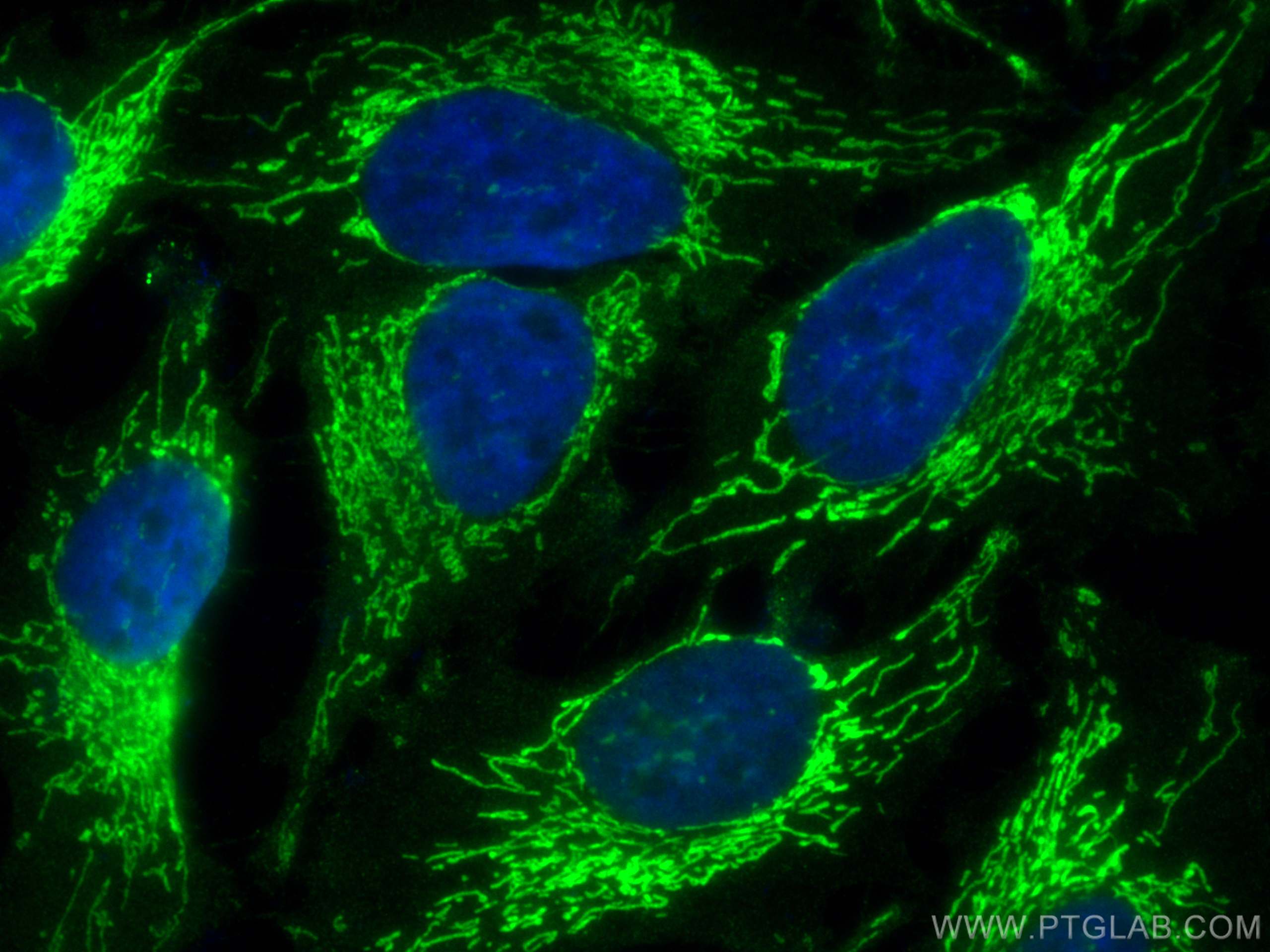 Immunofluorescence (IF) / fluorescent staining of HeLa cells using CoraLite® Plus 488-conjugated OXCT1 Monoclonal ant (CL488-67836)