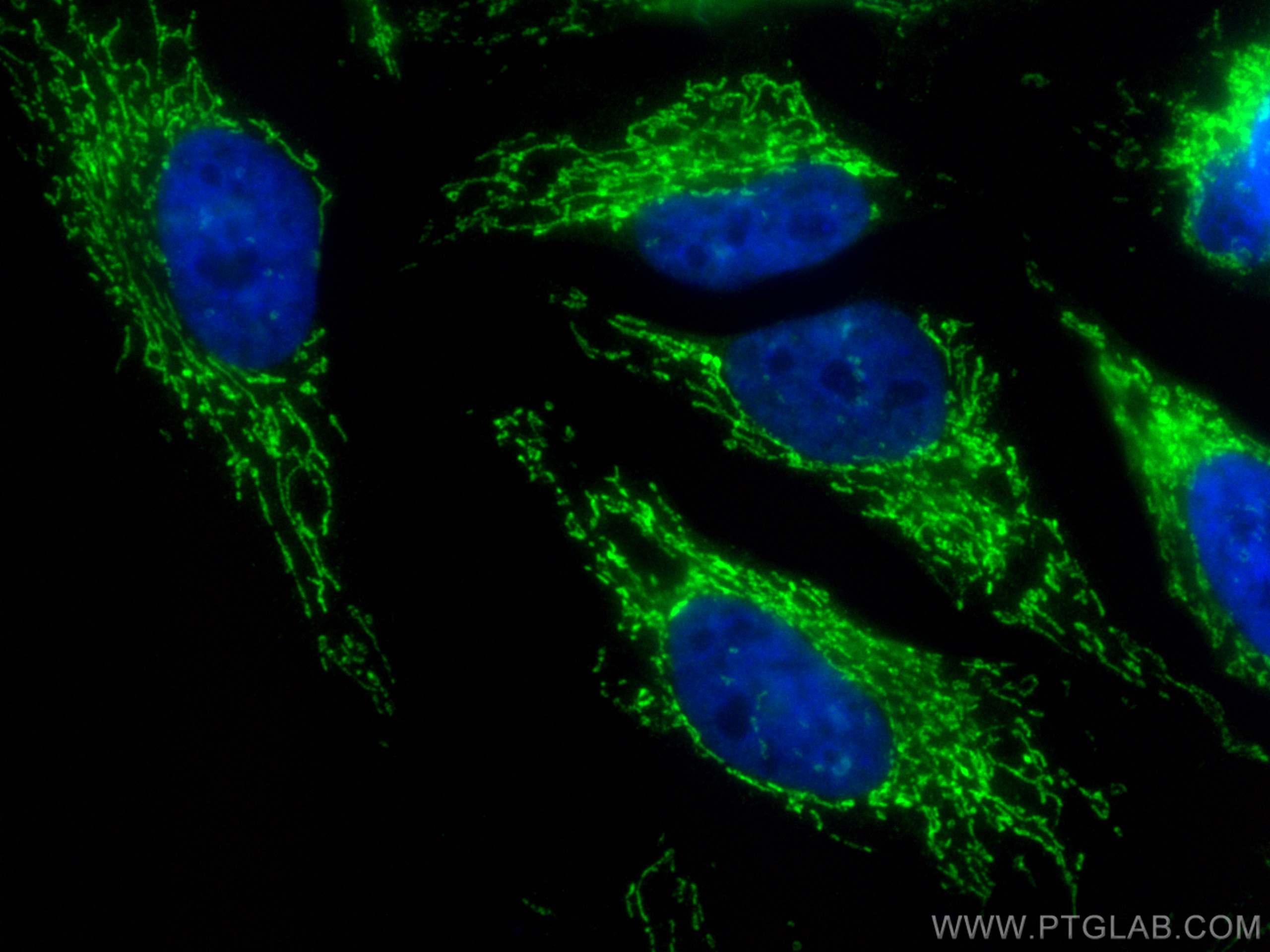 Immunofluorescence (IF) / fluorescent staining of HeLa cells using CoraLite® Plus 488-conjugated OXCT1 Recombinant an (CL488-81011)