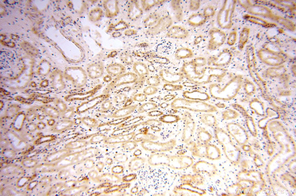 Immunohistochemistry (IHC) staining of human kidney tissue using OXCT2 Polyclonal antibody (17122-1-AP)