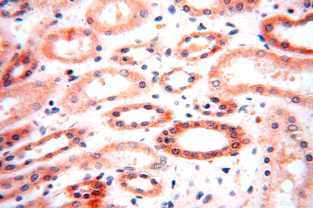 Immunohistochemistry (IHC) staining of human kidney tissue using OXCT2 Polyclonal antibody (17122-1-AP)