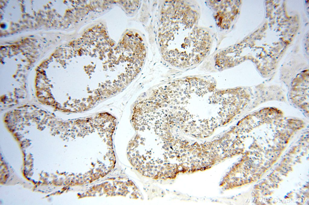 Immunohistochemistry (IHC) staining of human testis tissue using OXCT2 Polyclonal antibody (17122-1-AP)