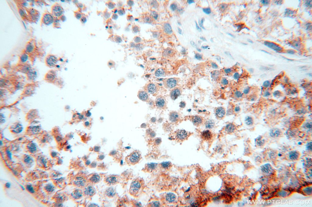 Immunohistochemistry (IHC) staining of human testis tissue using OXCT2 Polyclonal antibody (17122-1-AP)