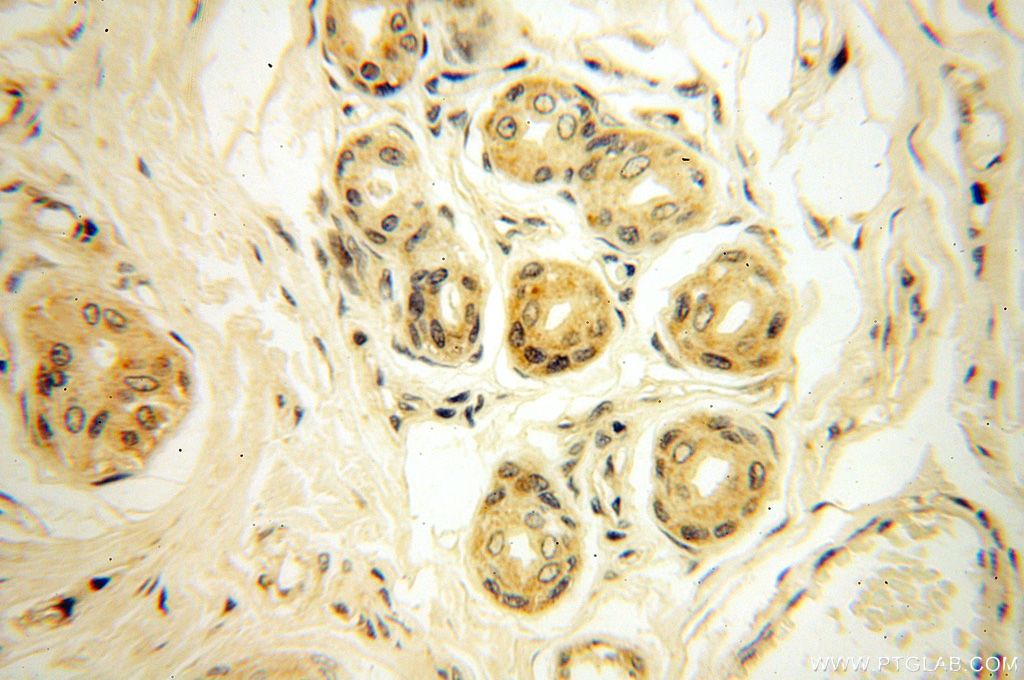 Immunohistochemistry (IHC) staining of human skin tissue using OXCT2 Polyclonal antibody (17122-1-AP)