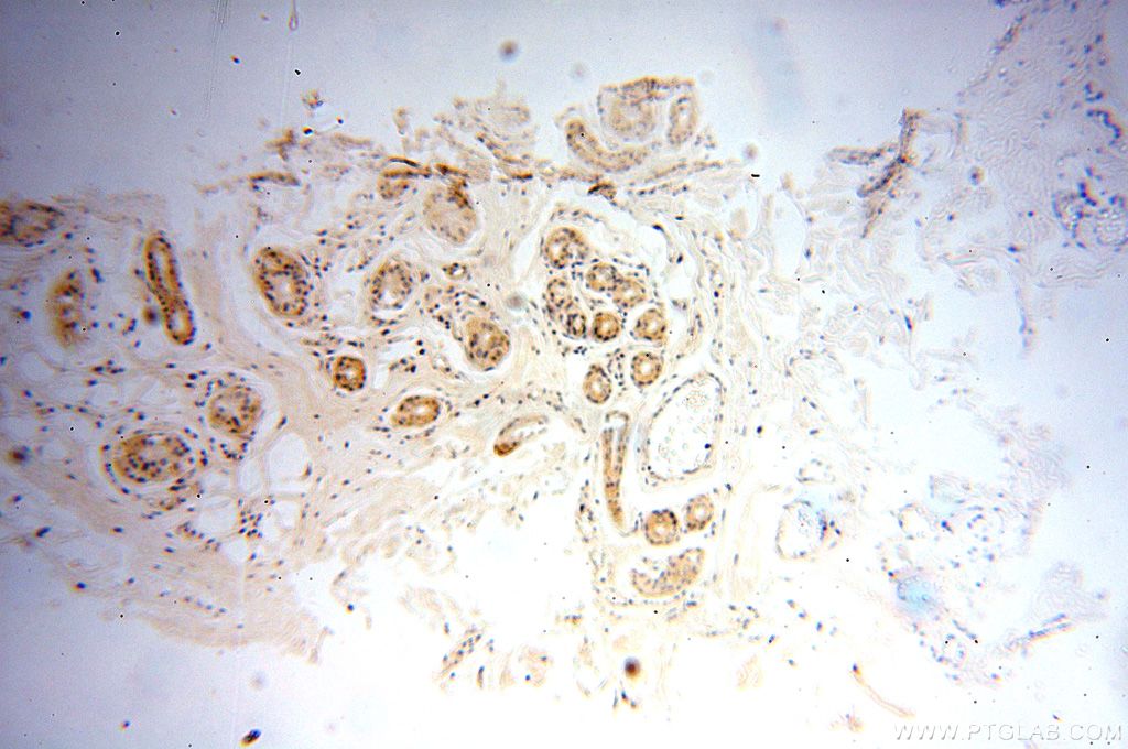 Immunohistochemistry (IHC) staining of human skin tissue using OXCT2 Polyclonal antibody (17122-1-AP)
