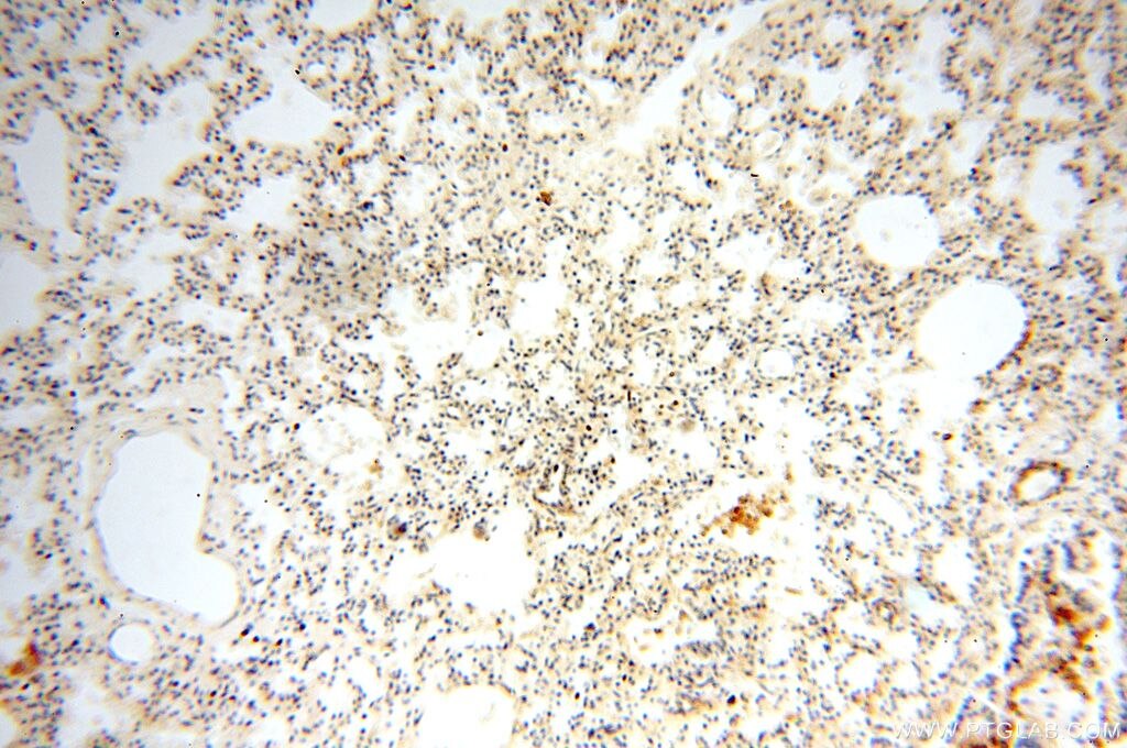 Immunohistochemistry (IHC) staining of human lung tissue using OXCT2 Polyclonal antibody (17122-1-AP)