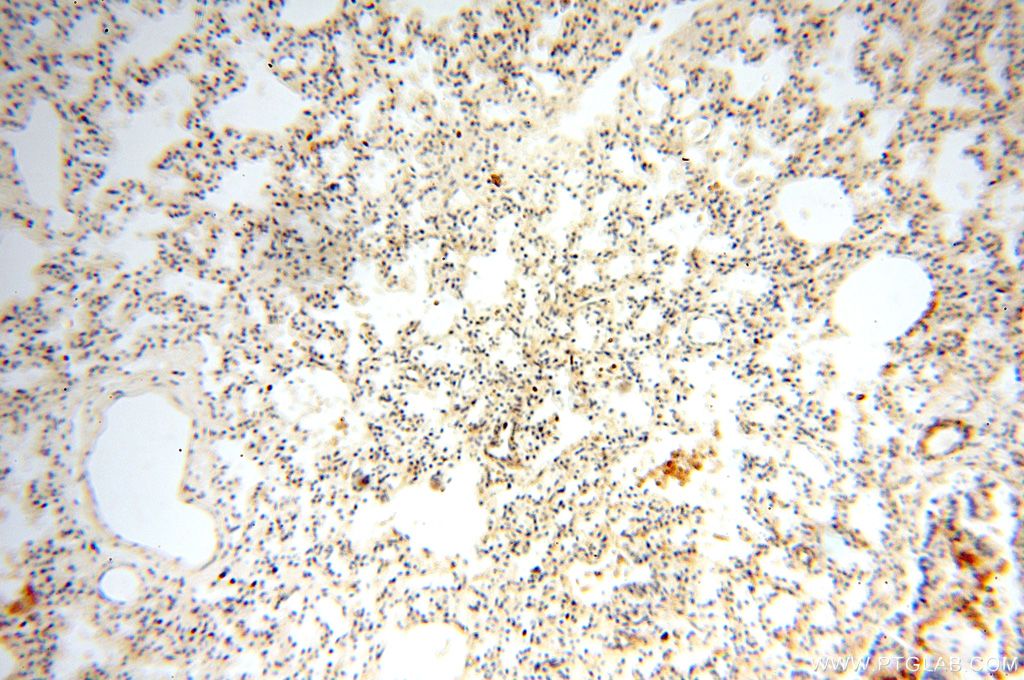 IHC staining of human lung using 17122-1-AP