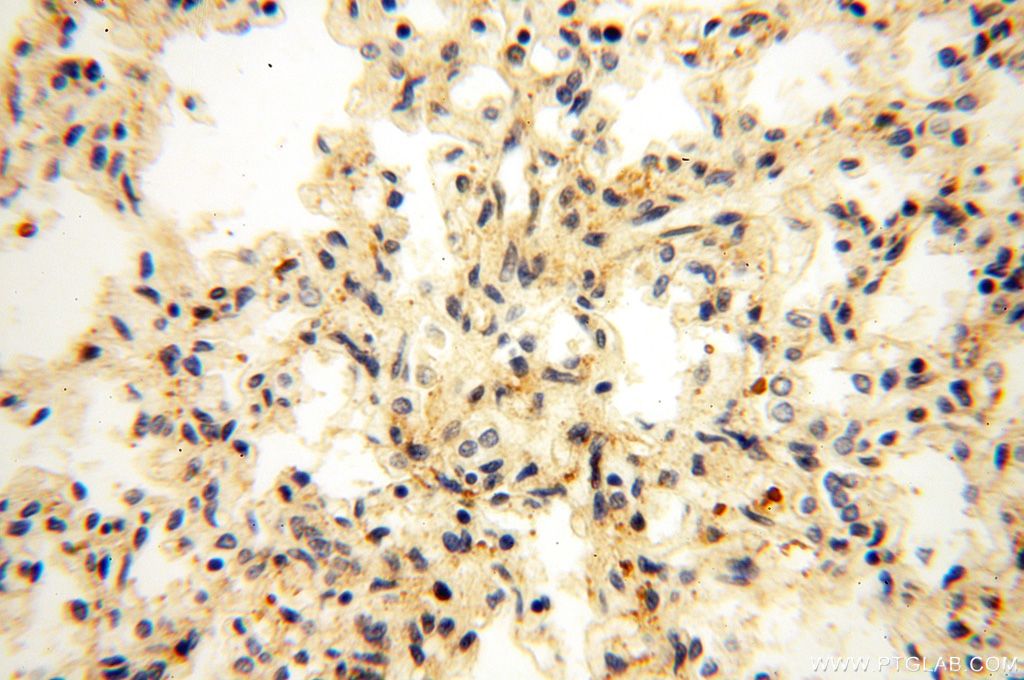 IHC staining of human lung using 17122-1-AP