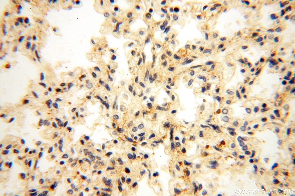 Immunohistochemistry (IHC) staining of human lung tissue using OXCT2 Polyclonal antibody (17122-1-AP)