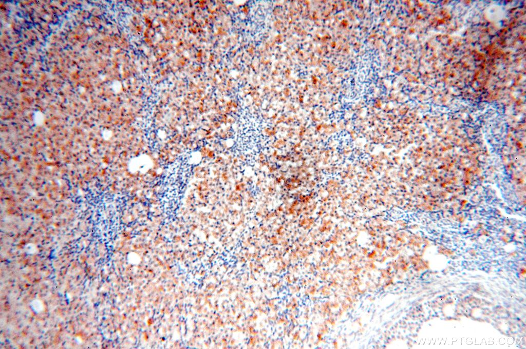 Immunohistochemistry (IHC) staining of human ovary tissue using OXCT2 Polyclonal antibody (17122-1-AP)