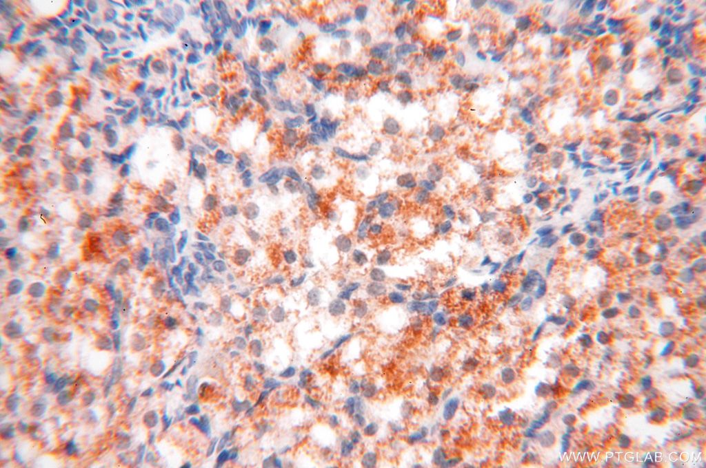 Immunohistochemistry (IHC) staining of human ovary tissue using OXCT2 Polyclonal antibody (17122-1-AP)