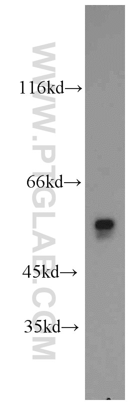 Western Blot (WB) analysis of mouse testis tissue using OXCT2 Polyclonal antibody (17122-1-AP)