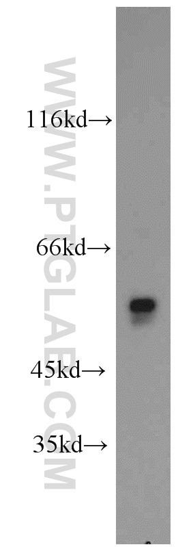 WB analysis of mouse testis using 17122-1-AP