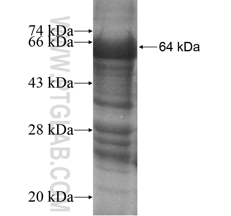 OXCT2 fusion protein Ag10810 SDS-PAGE