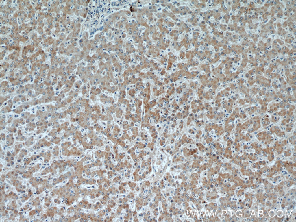 Immunohistochemistry (IHC) staining of human liver tissue using OXER1 Polyclonal antibody (55202-1-AP)