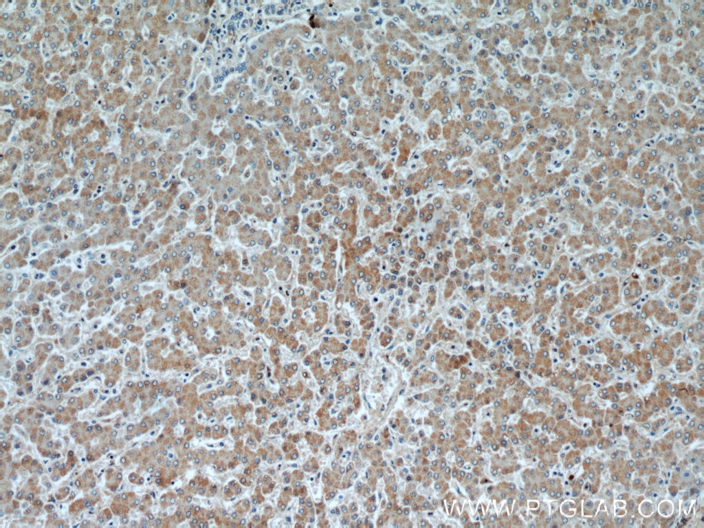 Immunohistochemistry (IHC) staining of human liver tissue using OXER1 Polyclonal antibody (55202-1-AP)