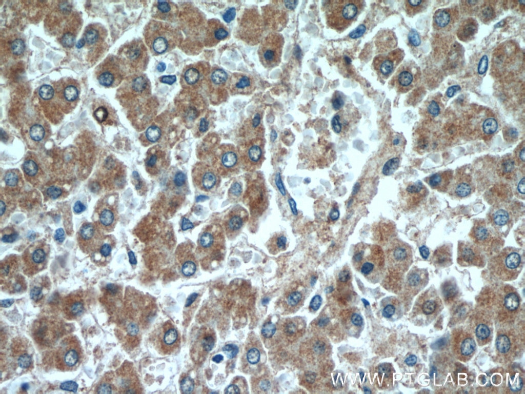 Immunohistochemistry (IHC) staining of human liver tissue using OXER1 Polyclonal antibody (55202-1-AP)