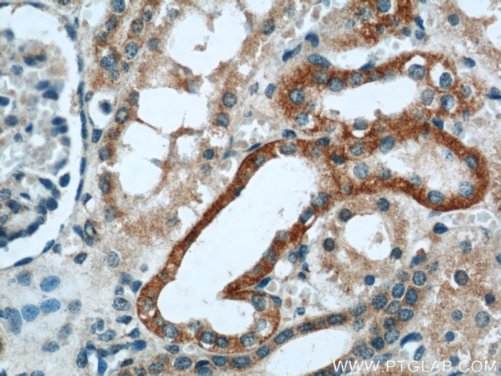 Immunohistochemistry (IHC) staining of human kidney tissue using OXER1 Polyclonal antibody (55202-1-AP)