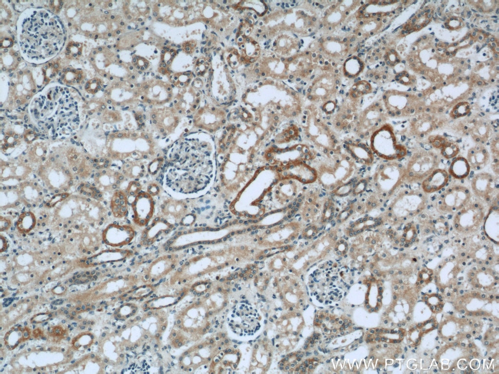 IHC staining of human kidney using 55202-1-AP