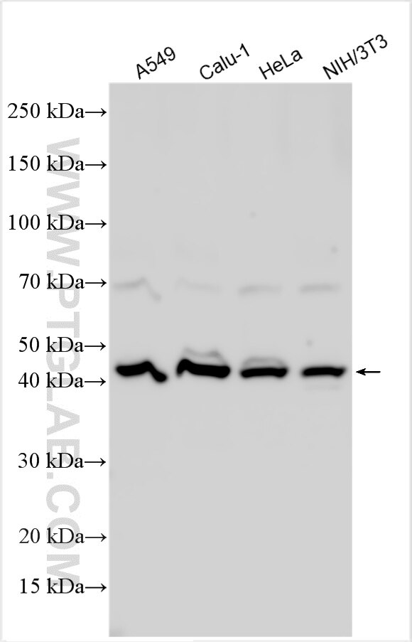 Various lysates were subjected to SDS PAGE followed by western blot with 22069-1-AP (OXGR1 antibody) at dilution of 1:3000 incubated at room temperature for 1.5 hours. Western Blot (WB) analysis of various lysates using OXGR1 Polyclonal antibody (22069-1-AP)