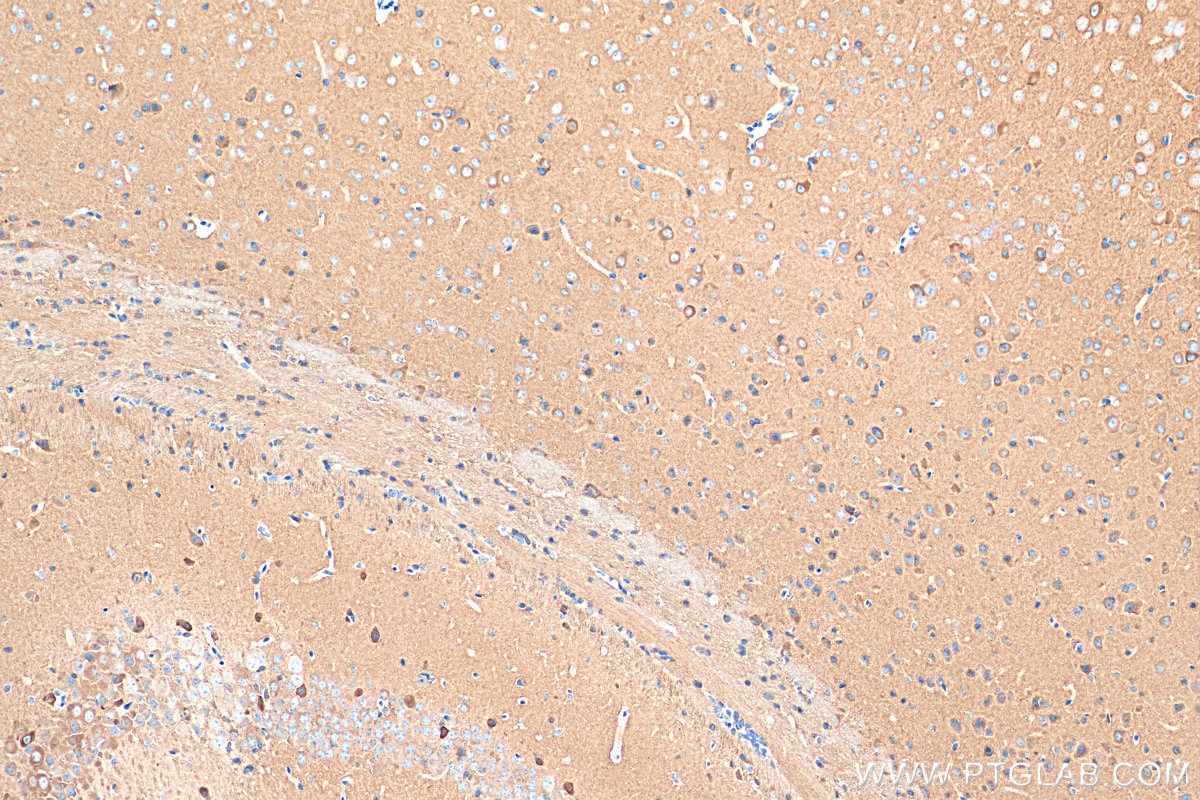 Immunohistochemistry (IHC) staining of mouse brain tissue using OXR1 Polyclonal antibody (13514-1-AP)