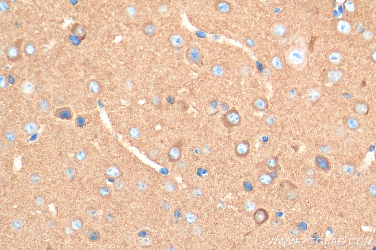 Immunohistochemistry (IHC) staining of mouse brain tissue using OXR1 Polyclonal antibody (13514-1-AP)