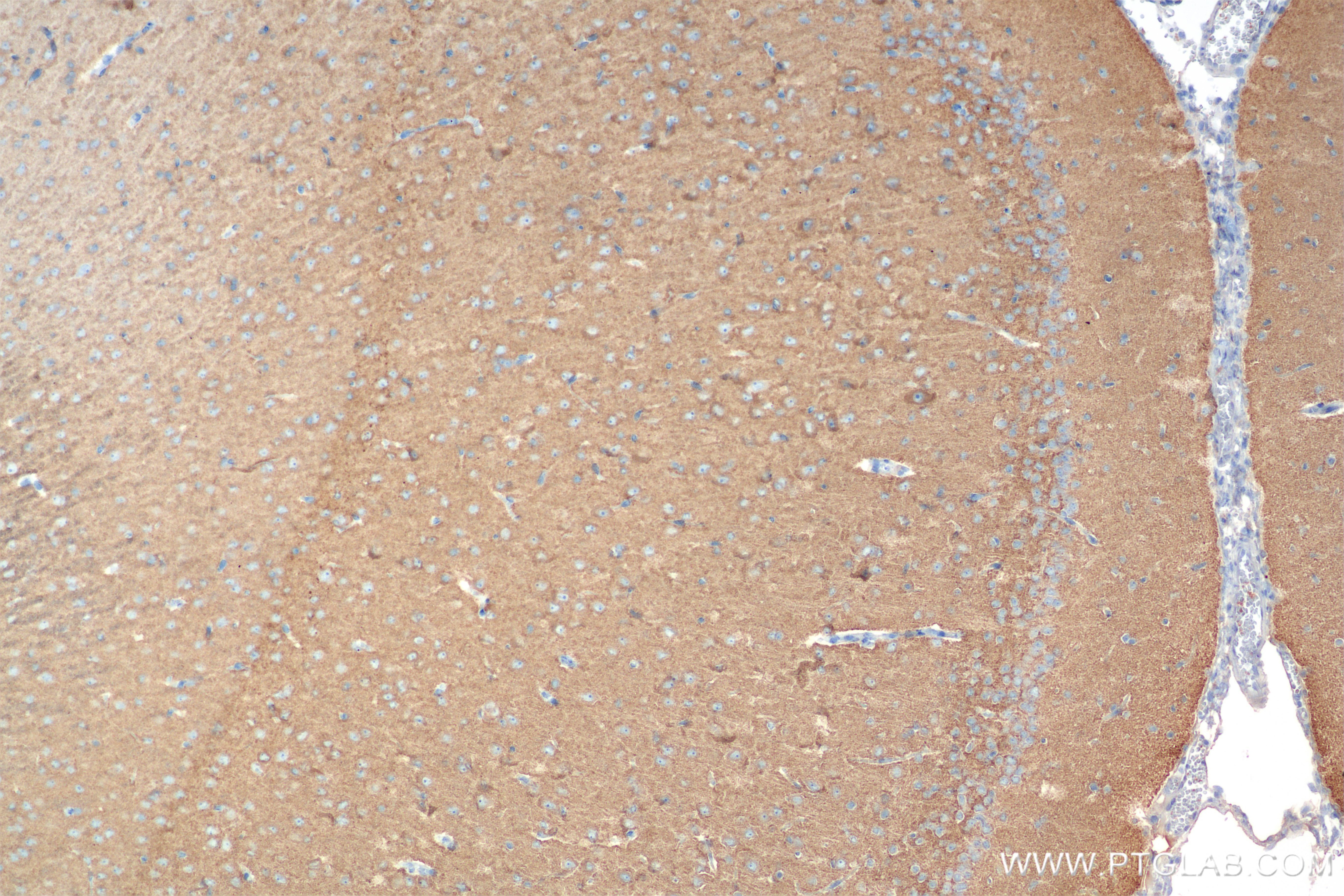 Immunohistochemistry (IHC) staining of rat brain tissue using OXR1 Recombinant antibody (86359-3-RR)