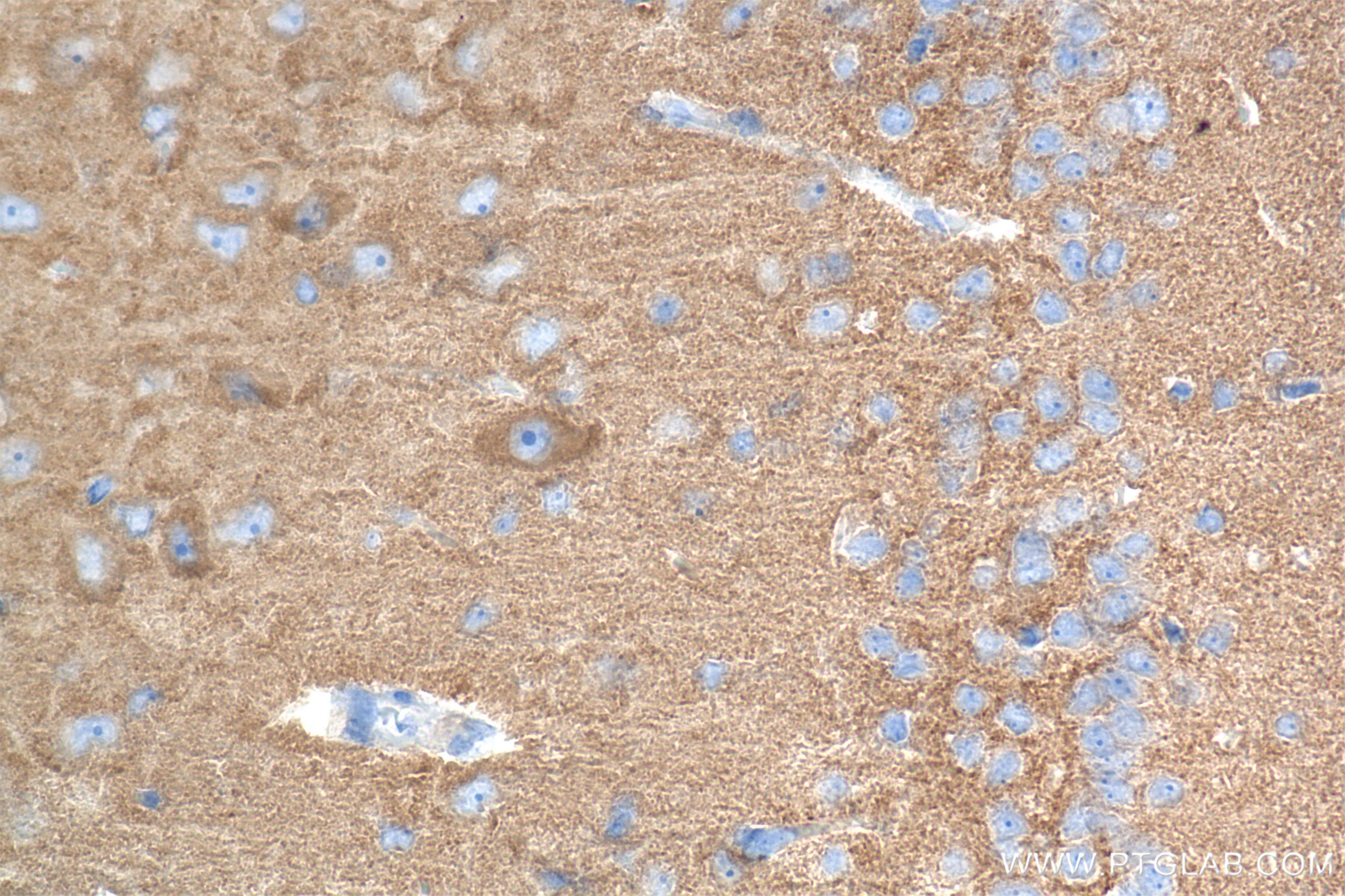 Immunohistochemistry (IHC) staining of rat brain tissue using OXR1 Recombinant antibody (86359-3-RR)