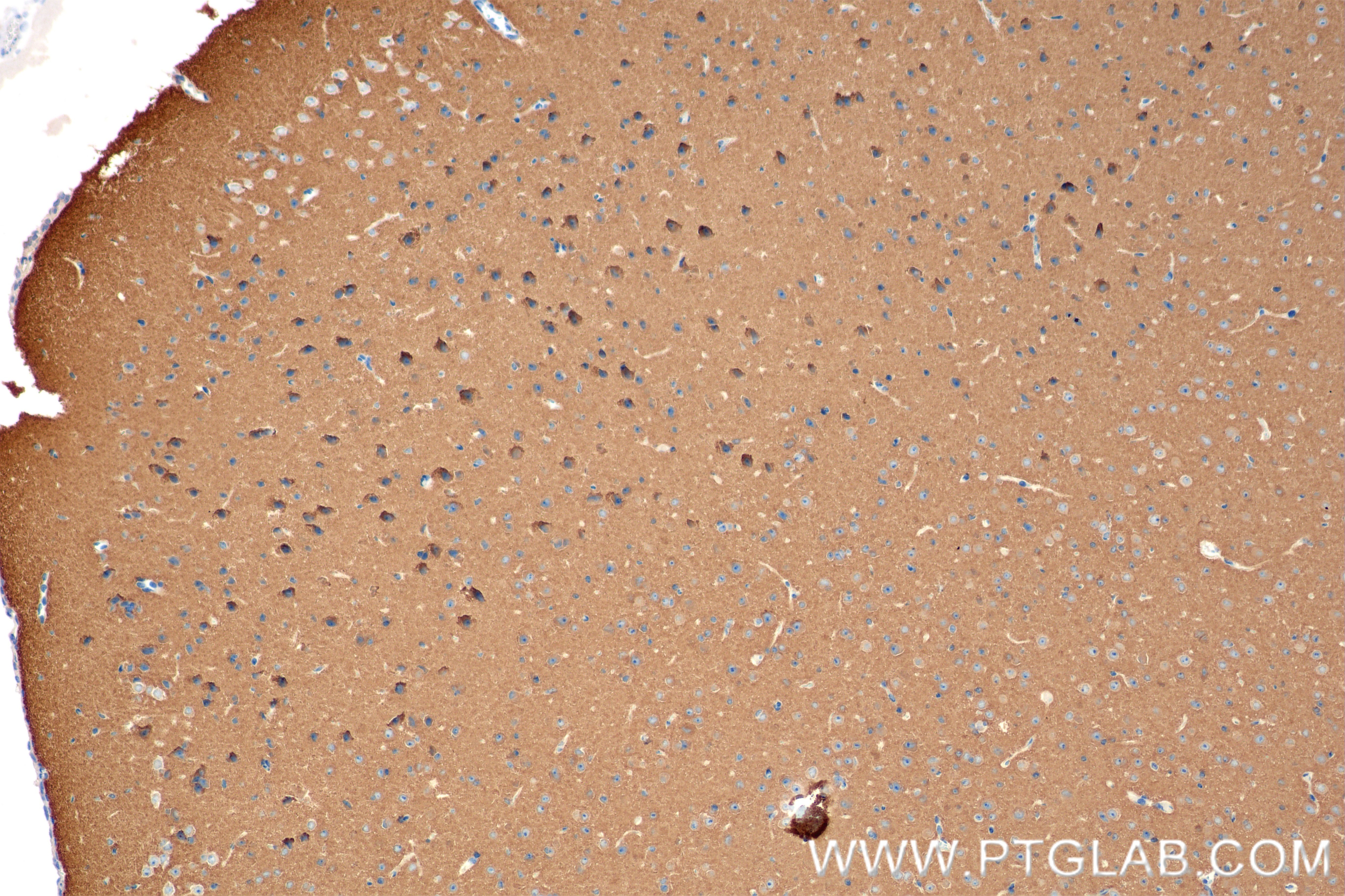 Immunohistochemistry (IHC) staining of mouse brain tissue using OXR1 Recombinant antibody (86359-3-RR)