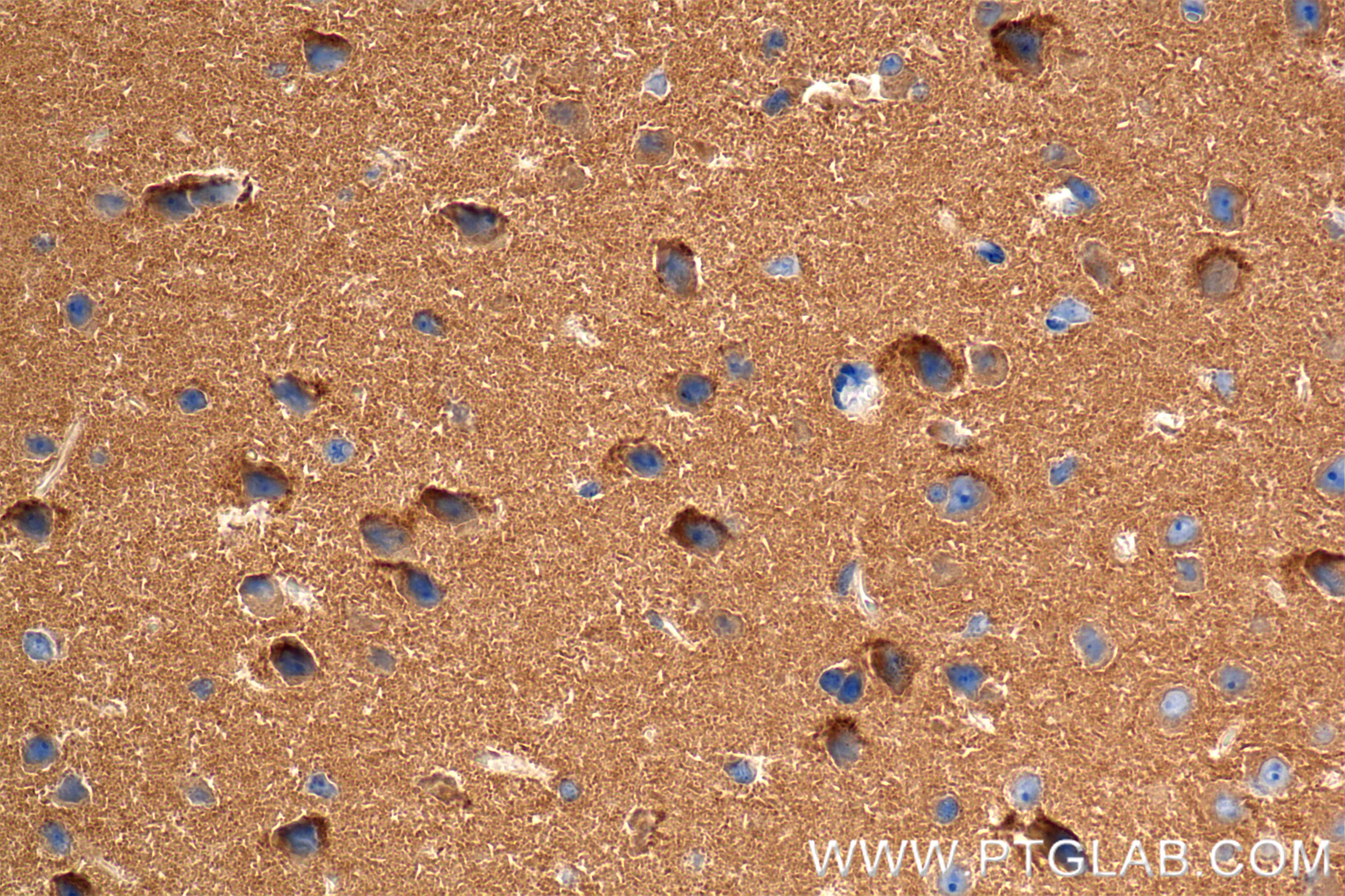 Immunohistochemistry (IHC) staining of mouse brain tissue using OXR1 Recombinant antibody (86359-3-RR)