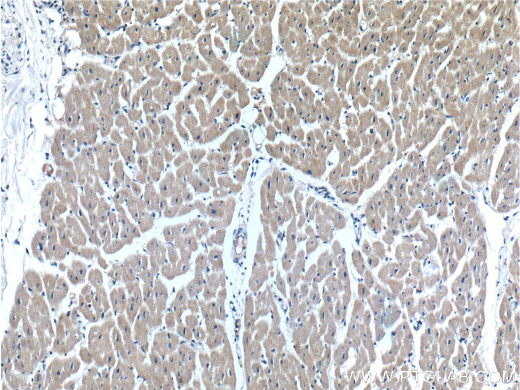 Immunohistochemistry (IHC) staining of human heart tissue using OXSM Polyclonal antibody (16642-1-AP)