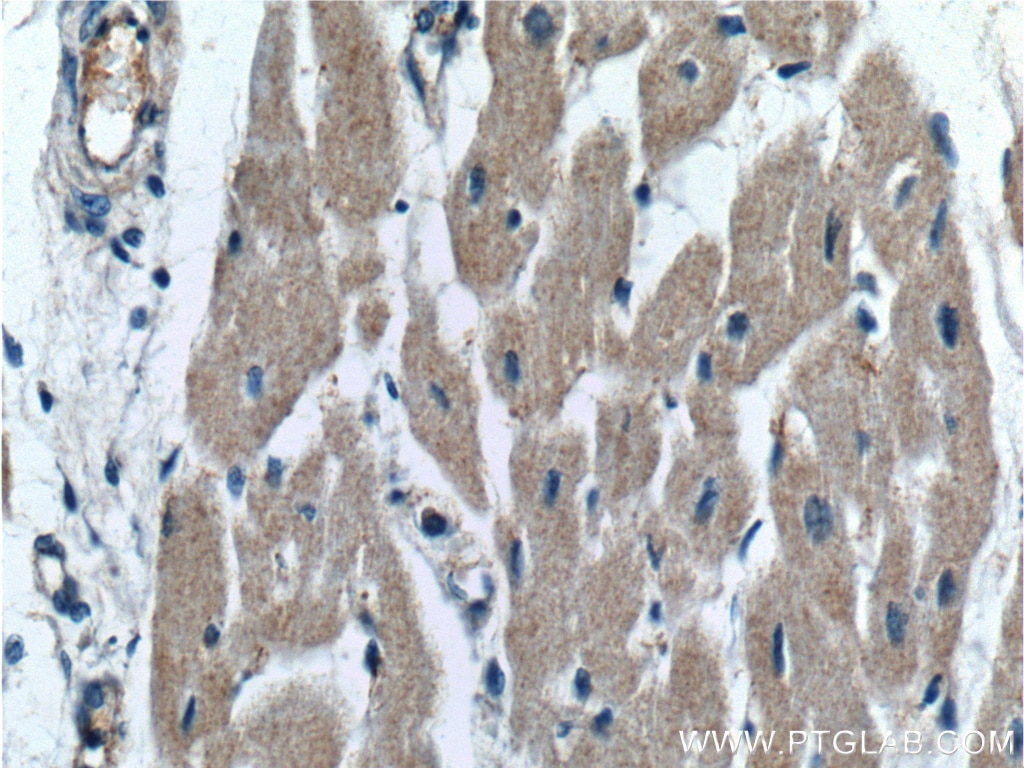 Immunohistochemistry (IHC) staining of human heart tissue using OXSM Polyclonal antibody (16642-1-AP)