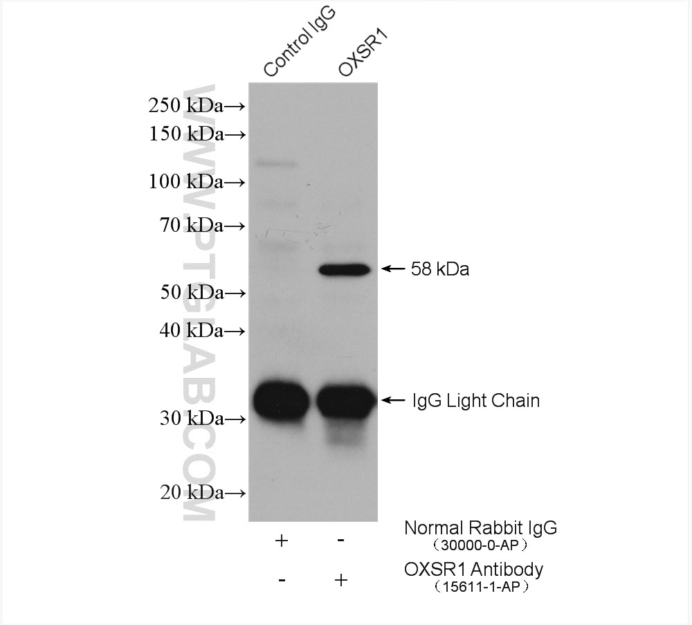 Immunoprecipitation (IP) experiment of HEK-293 cells using OXSR1 Polyclonal antibody (15611-1-AP)