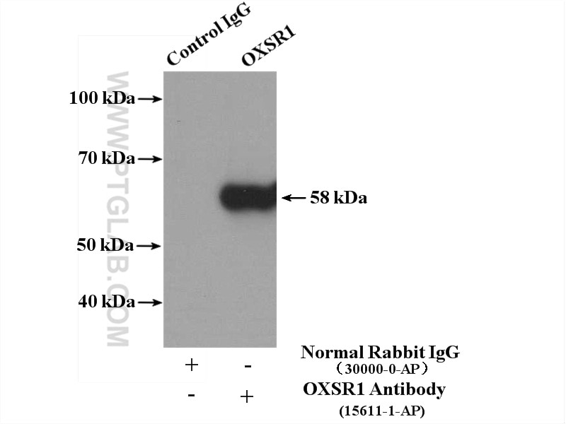 Immunoprecipitation (IP) experiment of HeLa cells using OXSR1 Polyclonal antibody (15611-1-AP)