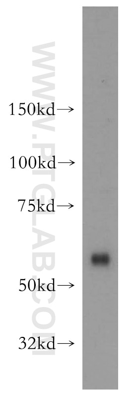 Western Blot (WB) analysis of human liver tissue using OXSR1 Polyclonal antibody (15611-1-AP)