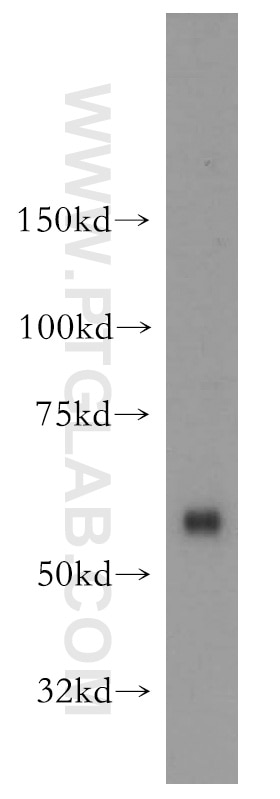 Western Blot (WB) analysis of human liver tissue using OXSR1 Polyclonal antibody (15611-1-AP)
