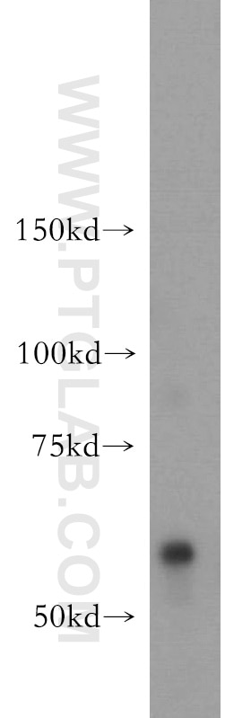 Western Blot (WB) analysis of human testis tissue using OXSR1 Polyclonal antibody (15611-1-AP)