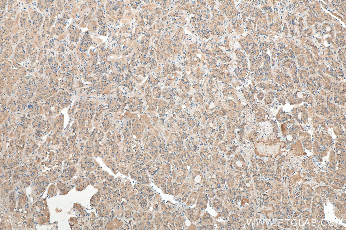 IHC staining of human pituitary using 18041-1-AP
