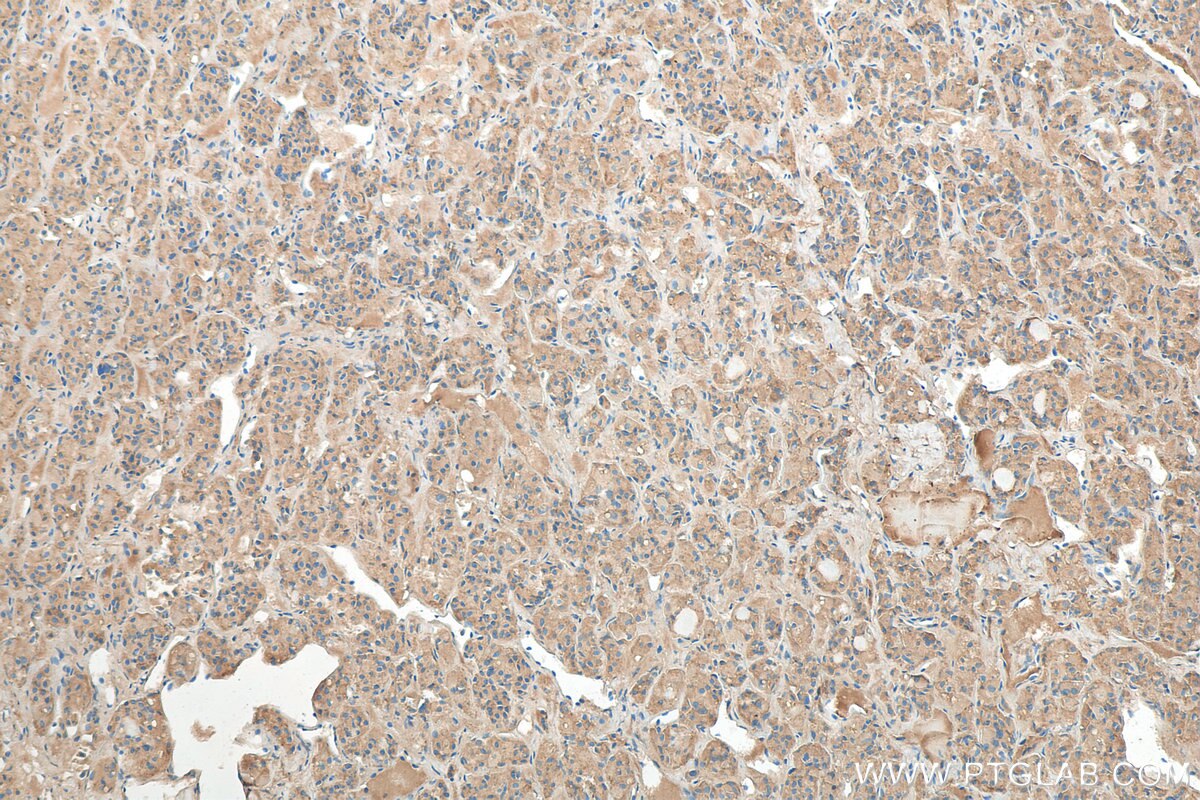 Immunohistochemistry (IHC) staining of human pituitary tissue using OXT Polyclonal antibody (18041-1-AP)