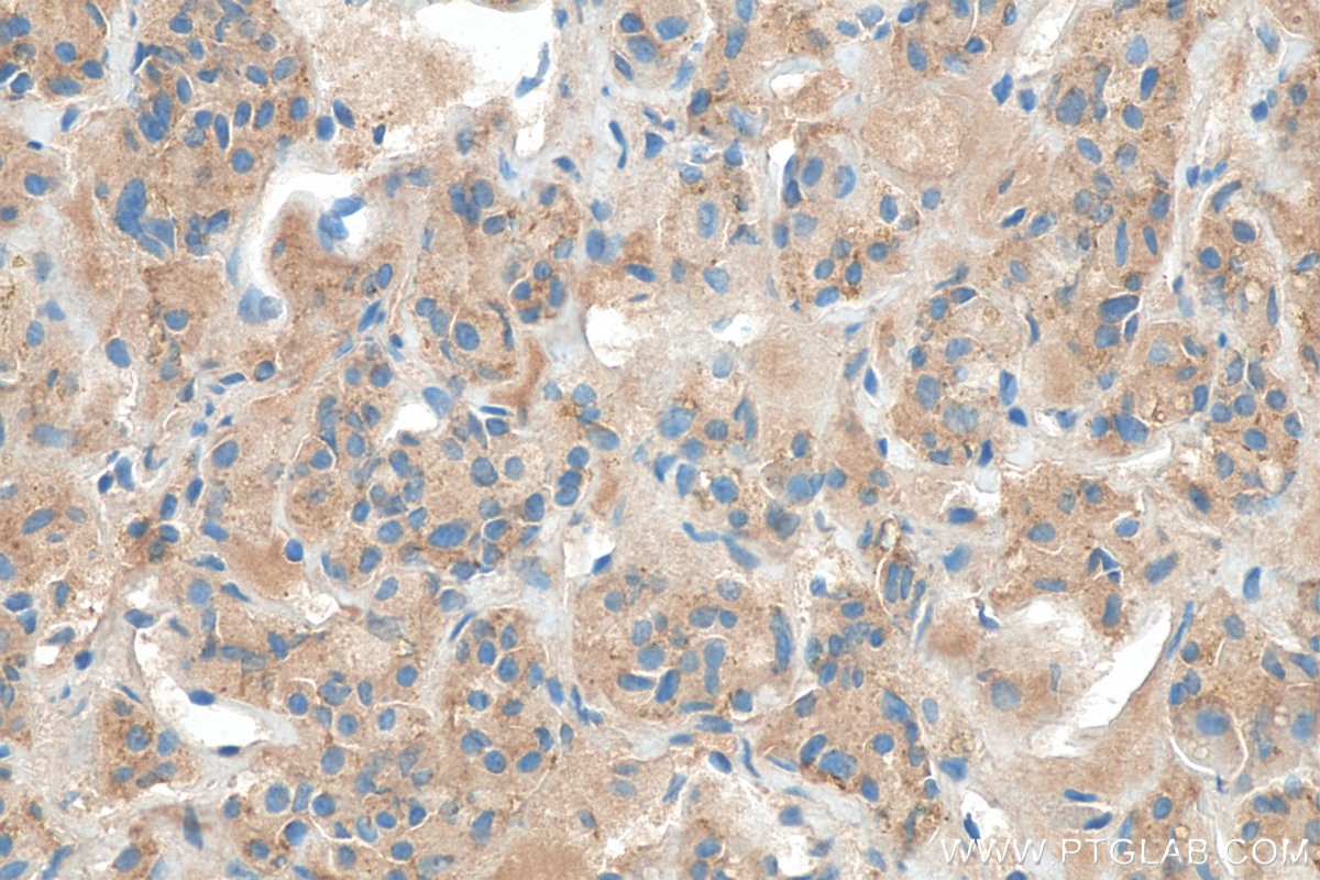 Immunohistochemistry (IHC) staining of human pituitary tissue using OXT Polyclonal antibody (18041-1-AP)