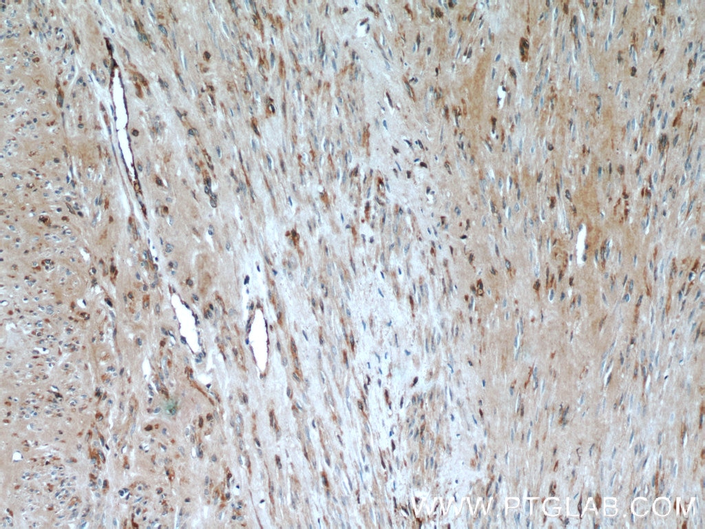 Immunohistochemistry (IHC) staining of human hysteromyoma tissue using OXTR Polyclonal antibody (23045-1-AP)