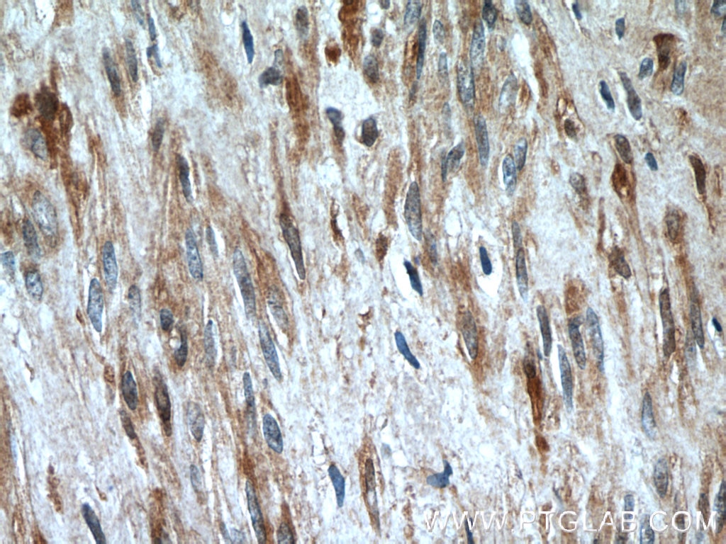 Immunohistochemistry (IHC) staining of human hysteromyoma tissue using OXTR Polyclonal antibody (23045-1-AP)