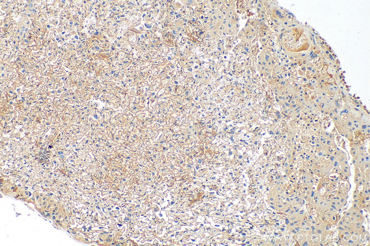 Immunohistochemistry (IHC) staining of mouse placenta tissue using OXTR Polyclonal antibody (23045-1-AP)