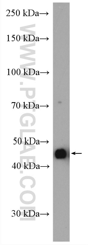 Western Blot (WB) analysis of HeLa cells using OXTR Polyclonal antibody (23045-1-AP)